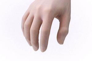 ツムラ猪苓湯で得られる効果とは