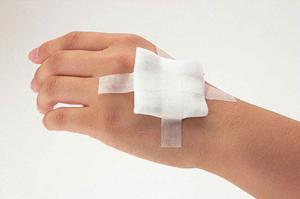 美しい歯並びを手に入れるための矯正歯科治療のポイント