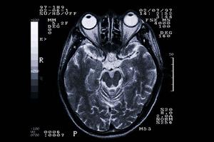 今治市で矯正治療が得意な人を見つけよう