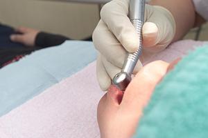 口腔外科で知っておきたい！余戸に関する重要な情報