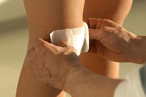 世田谷区で人気のインビザライン治療とは？目立たない矯正法のメリットと効果を徹底解説