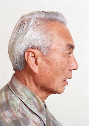 口コミで評判の安心なインプラント治療