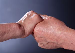 札幌でも透明なマウスピース矯正が人気