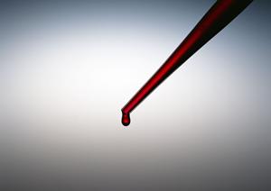 歯並び悩みを解消！効果的なインビザライン治療を天王寺で受ける方法